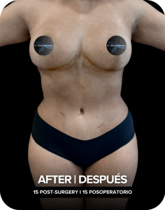 DESPUES-#2