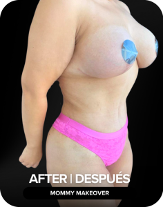 Despues#1
