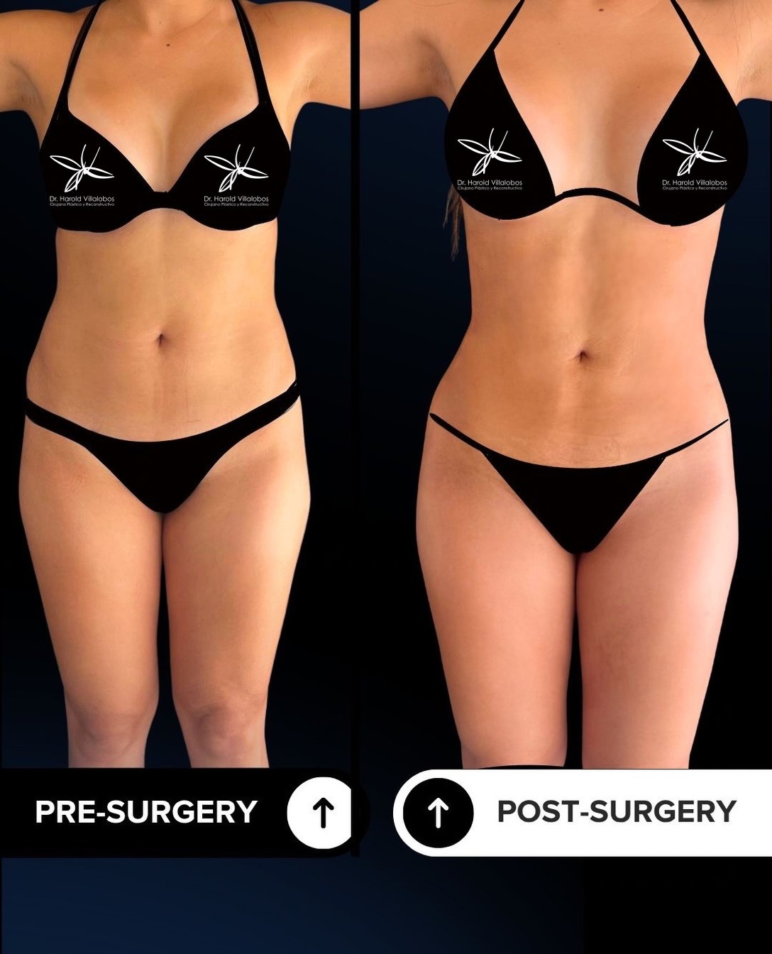 Resultado de un caso real RIB-BOX bajo condiciones fotográficas comparables